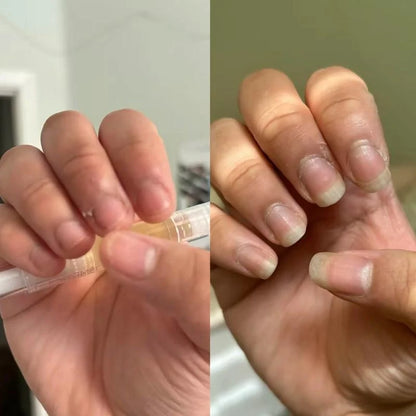 Avera Paris Nail Growth Oil