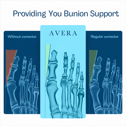 Avera Paris™ EMS Bunion Fix