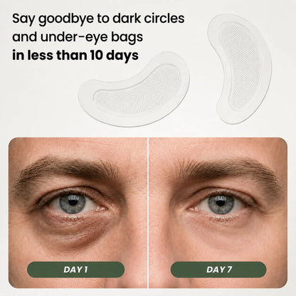 Microneedle Patches - Next Generation
